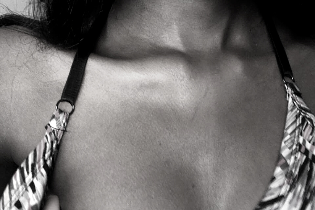 MY EVERYTHING CREAM FOR CHEMO RADIATION BURNS