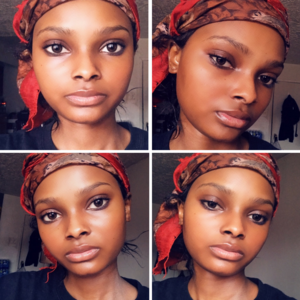 Clear Skin is Possible